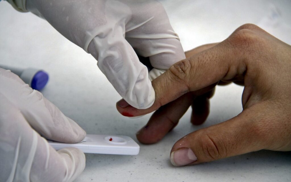 Sida podría erradicarse en 2030, pero urge financiación: ONU