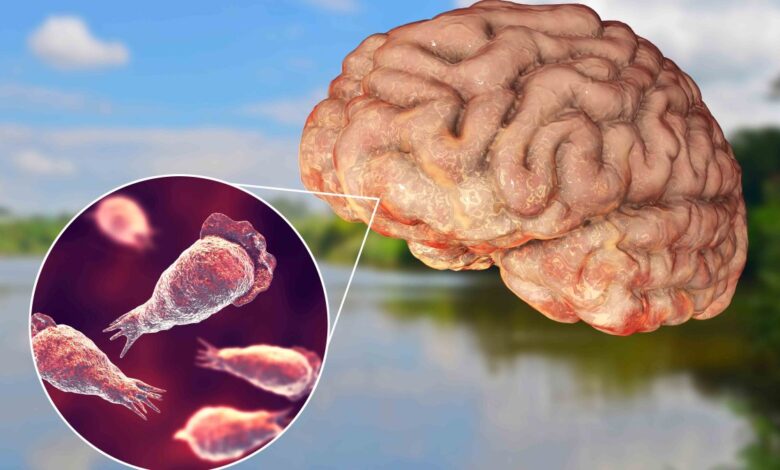 la ameba comecerebro mata a una persona en Georgia