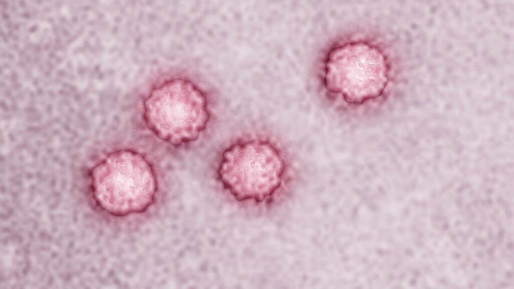 Advierten sobre posible exposición a hepatitis A en Panda Express de Lancaster