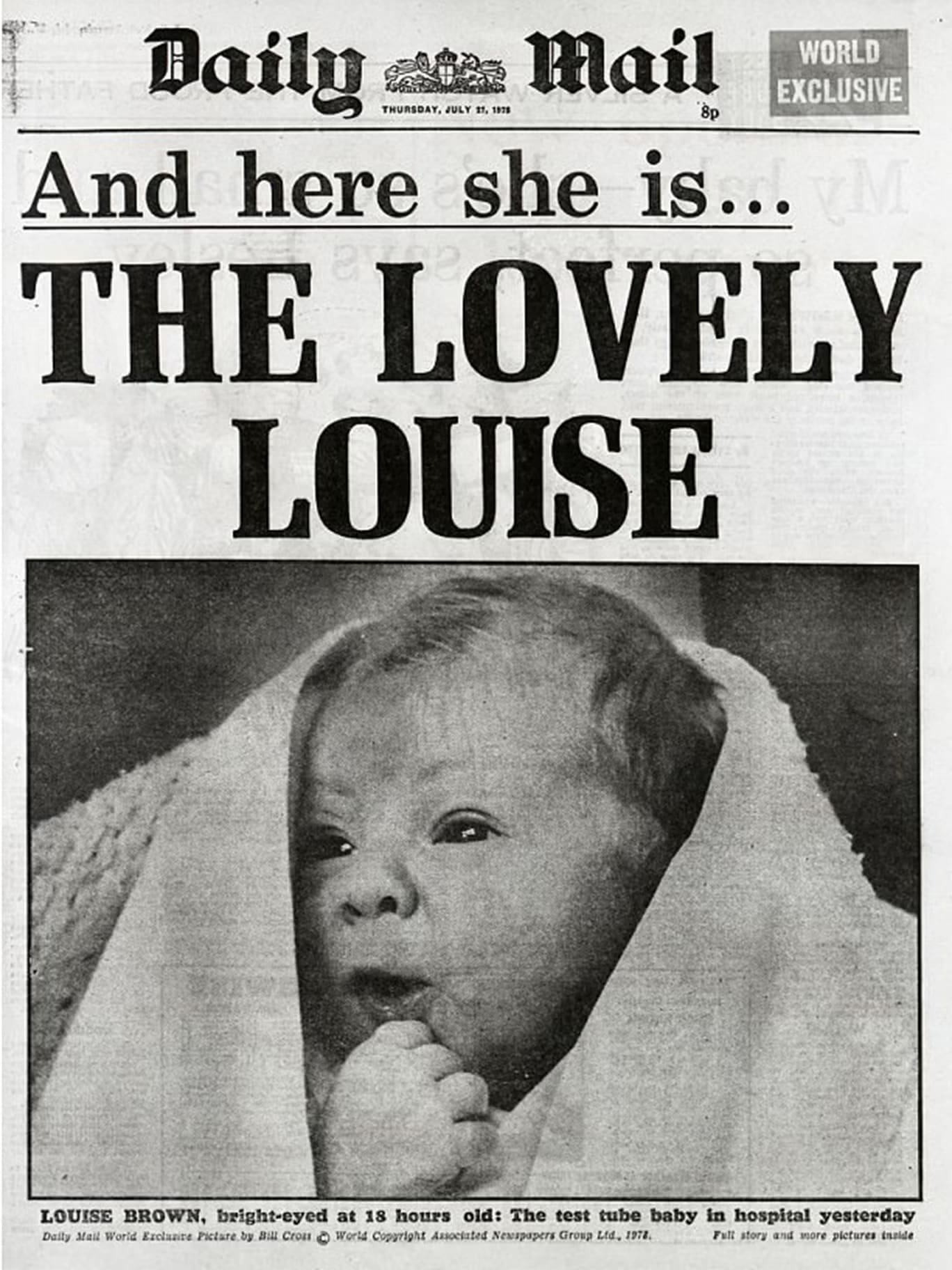 periódico para el encantador bebé louise ivf