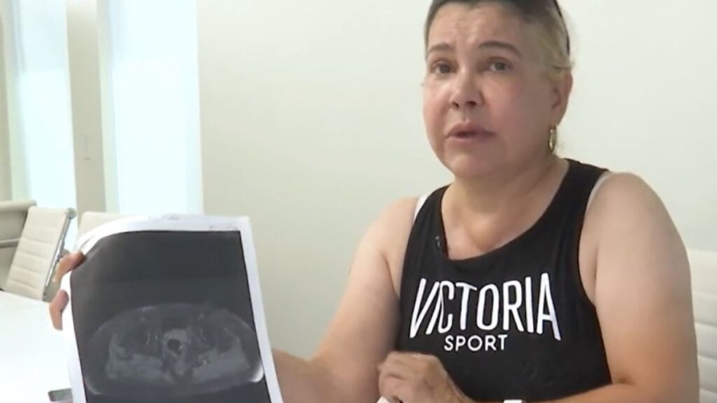 Mujer de Utah lucha por su vida tras inyectarse biopolímeros