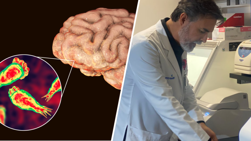 Prueba revolucionaria puede detectar la ameba comecerebros en 5 horas