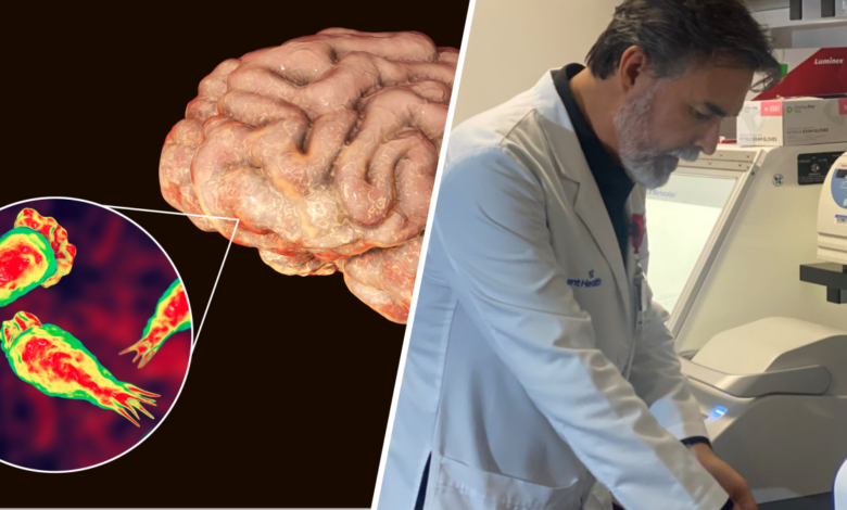 Prueba revolucionaria puede detectar la ameba comecerebros en 5 horas