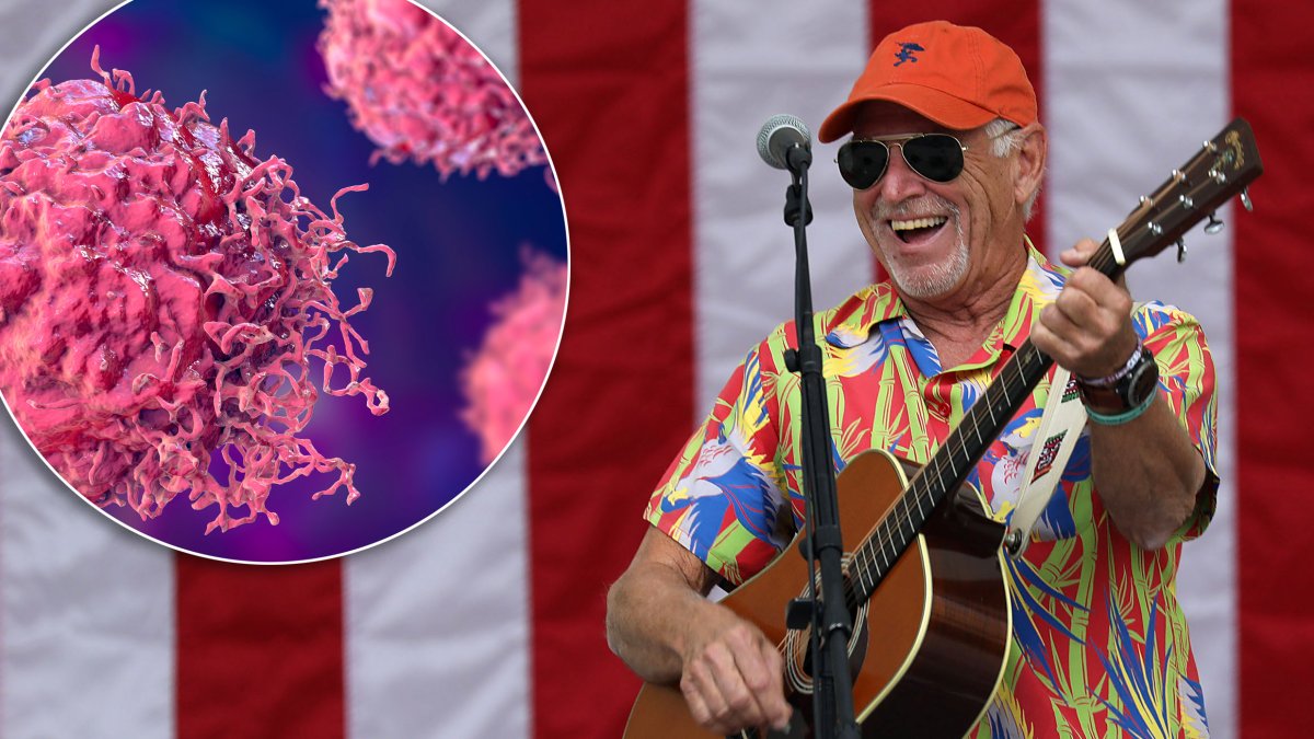 Qué es el carcinoma de células de Merkel, el cáncer que mató al cantante Jimmy Buffett