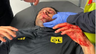 Paga técnico del Olympique Lyon por la ola de violencia en el futbol galo | Video