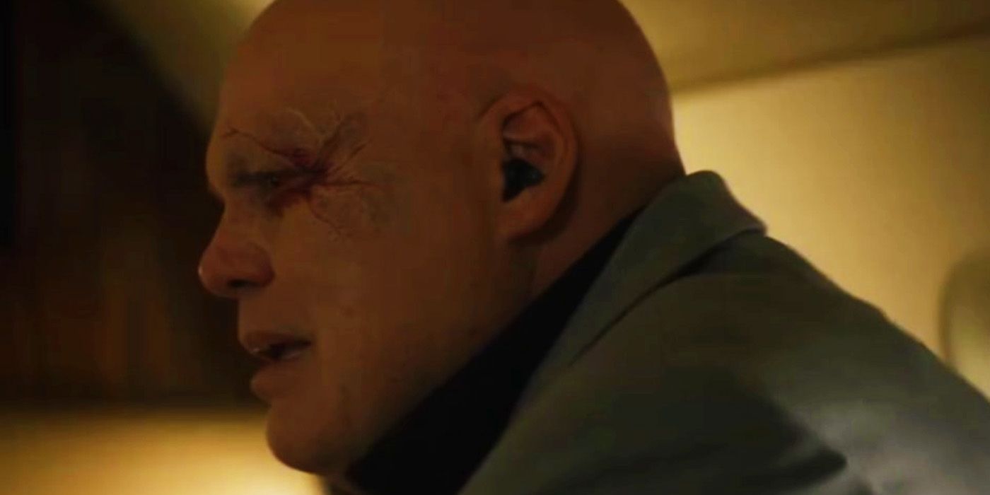 El ojo cicatrizado de Kingpin en Echo