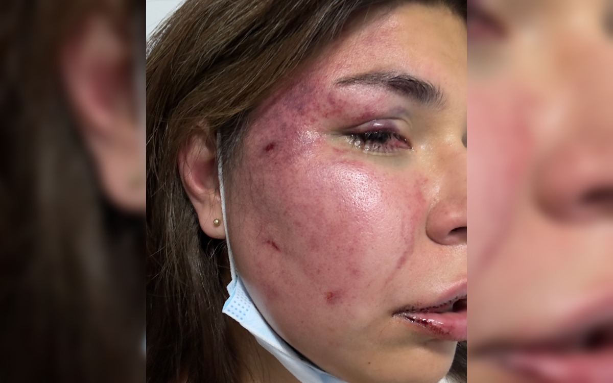 Mexicana denuncia intento de feminicidio en Colombia