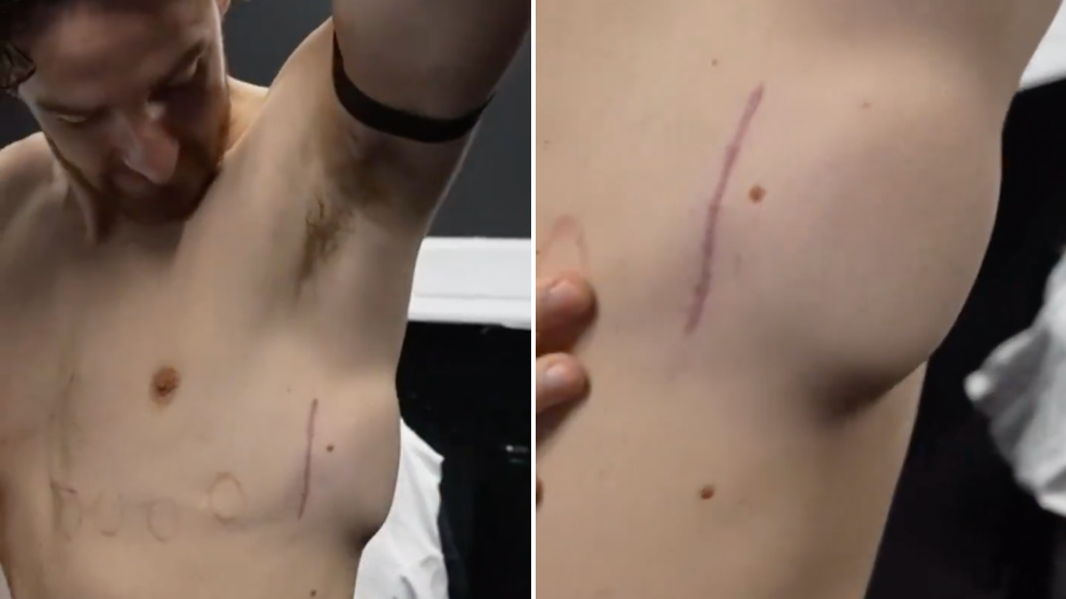 Tom Lockyer, futbolista que sufrió un paro cardíaco a pleno partido, explica como funciona su desfibrilador | Video