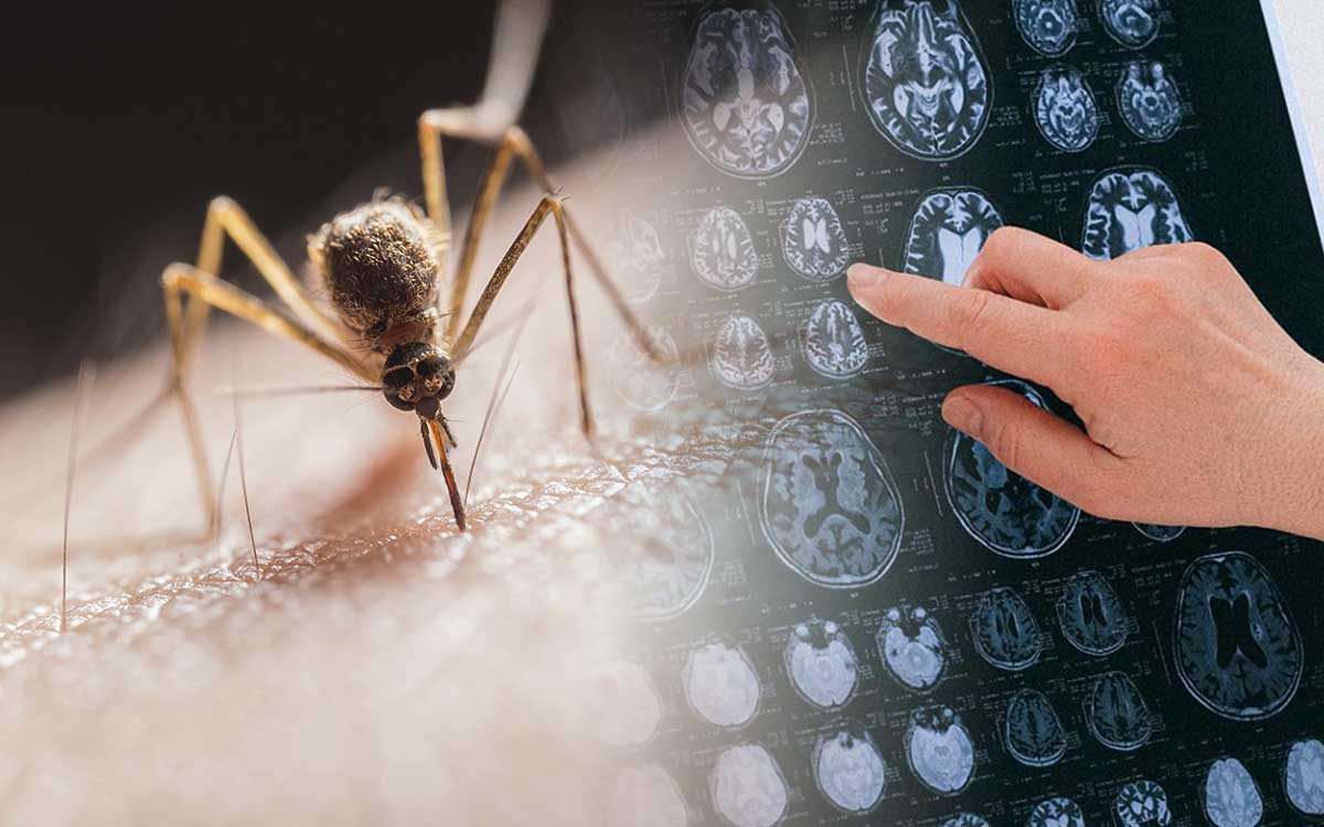 Uruguay confirma el primer caso de encefalitis equina en una persona