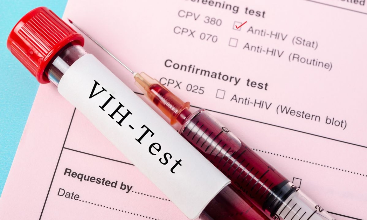 Corte de fondos por parte de EU para programas contra VIH pone en riesgo de 'muerte' a pacientes: Tedros