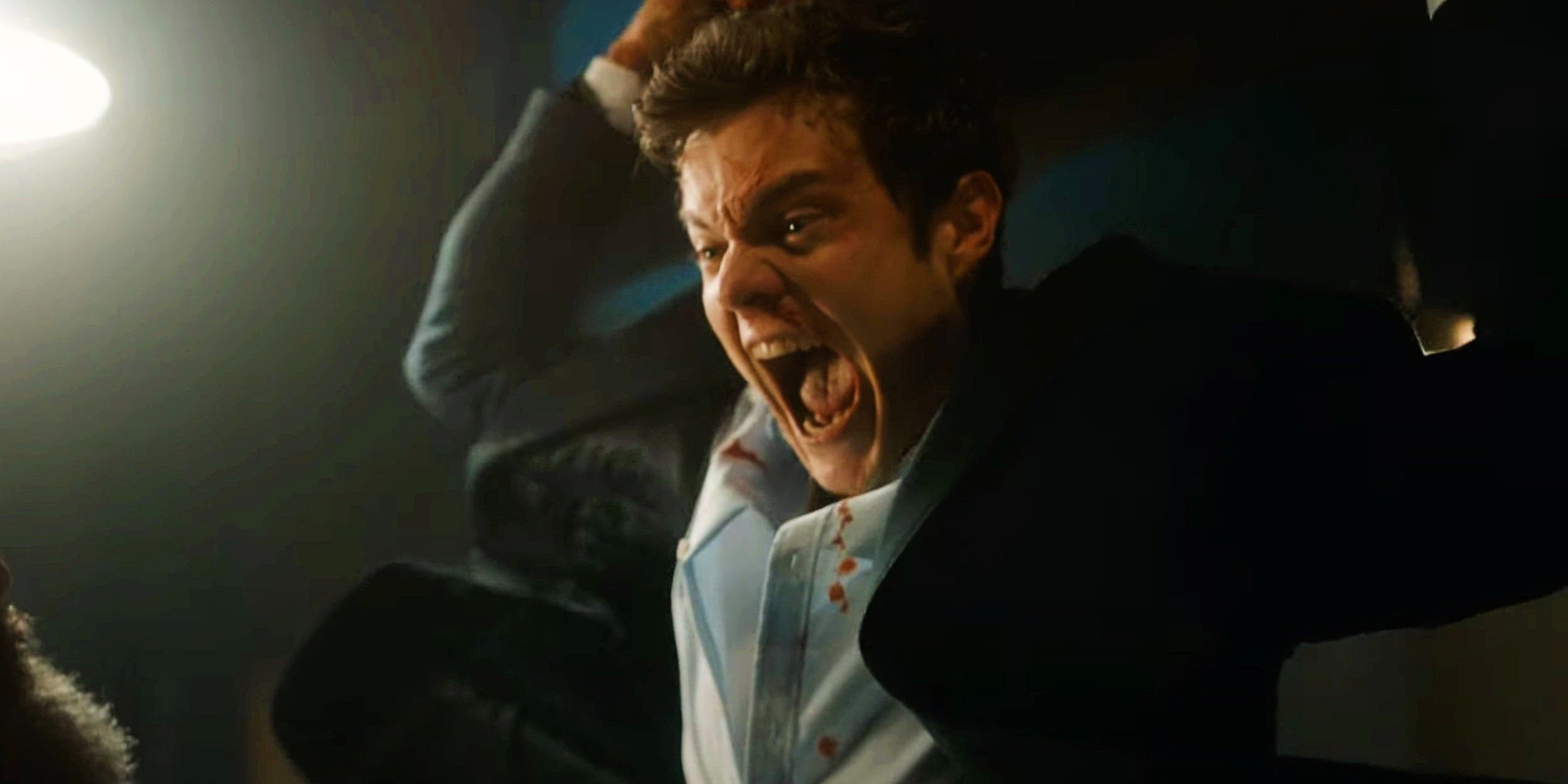 Tráiler de novocaína: Jack Quaid no siente dolor y debe rescatar a su novia en un thriller de acción de alto octanaje