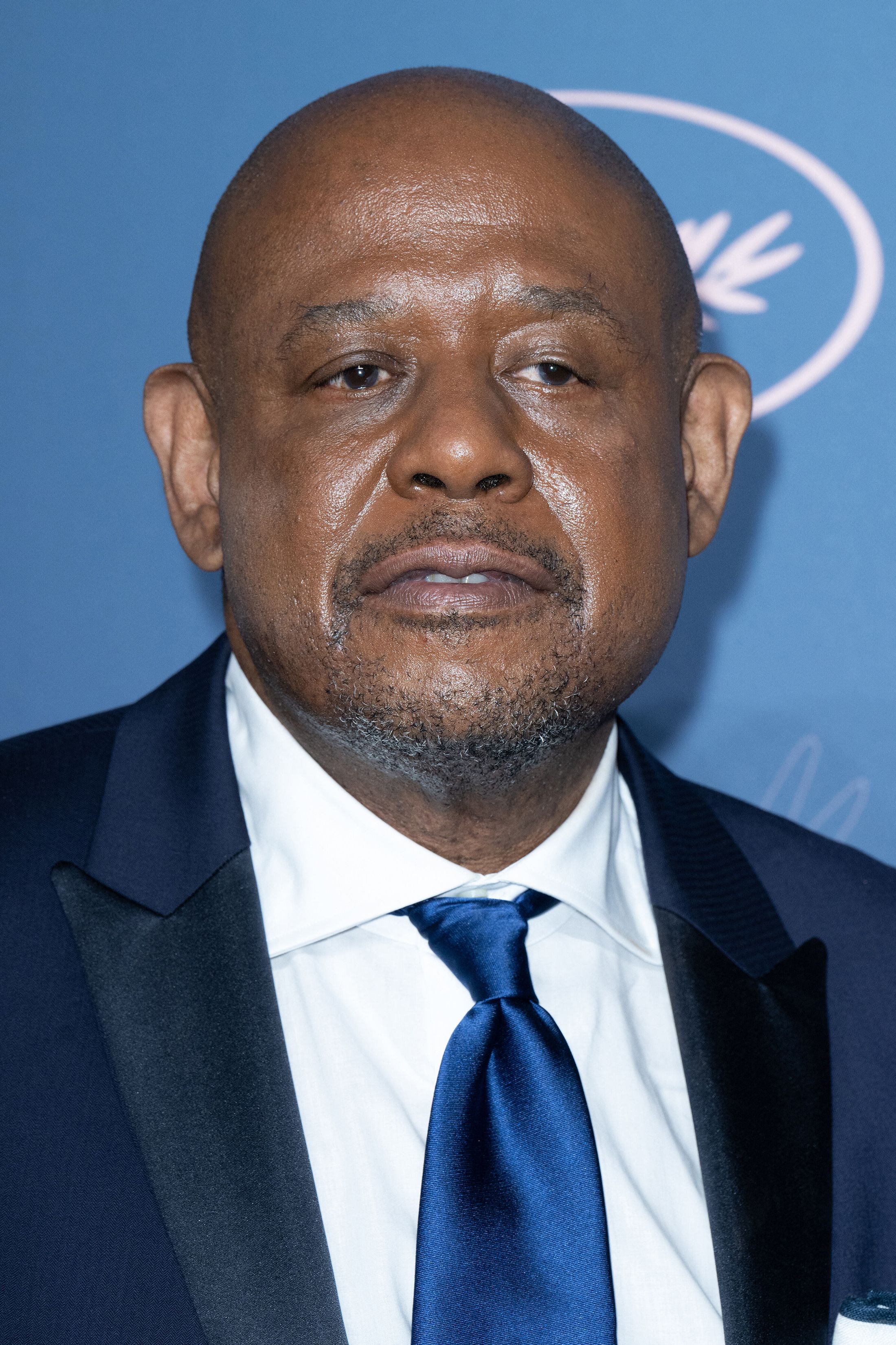 Tiro en la cabeza de Forest Whitaker
