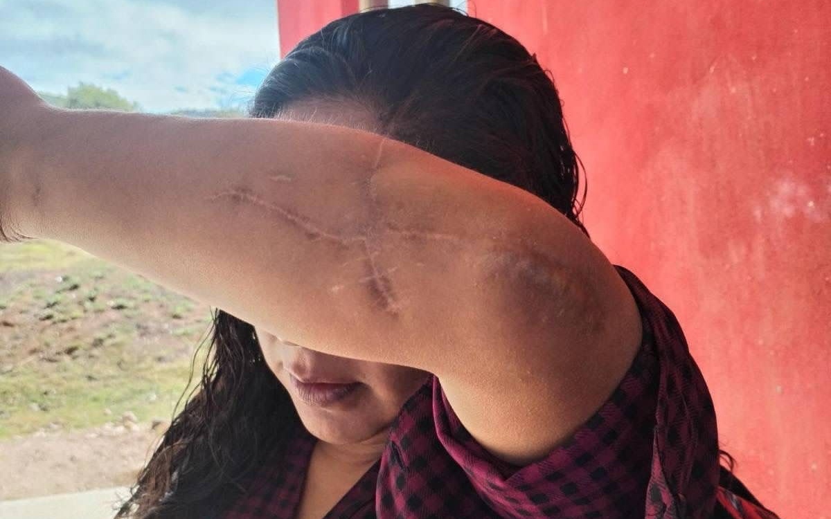 'Temo por mi vida, un juez liberó a quien quiso matarme': mixteca víctima de intento de feminicidio