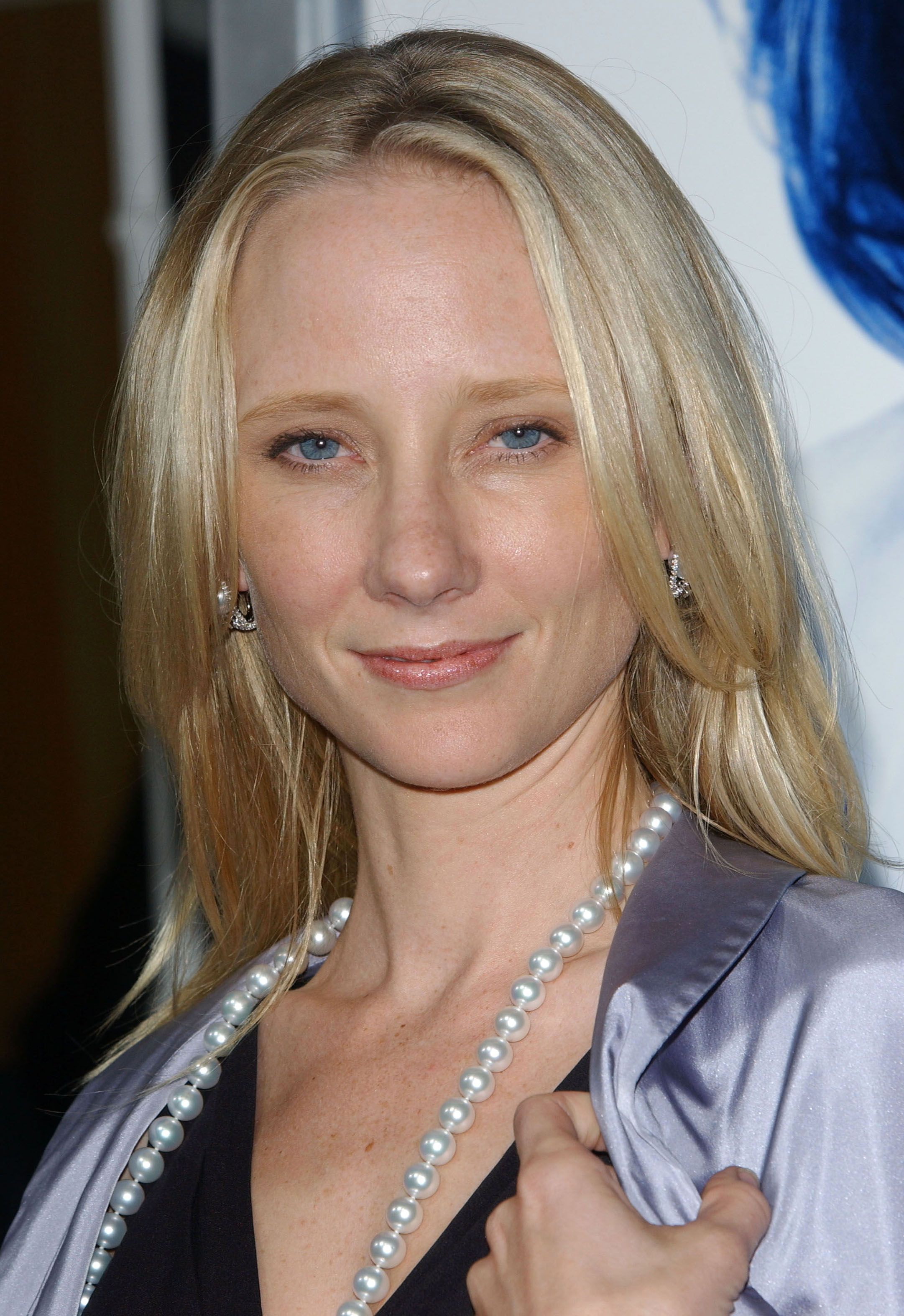 Tiro en la cabeza de Anne Heche