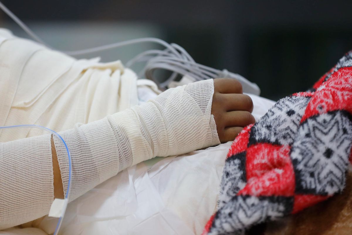 Quemaduras en adolescentes por pugnas del crimen ponen en alerta a expertos