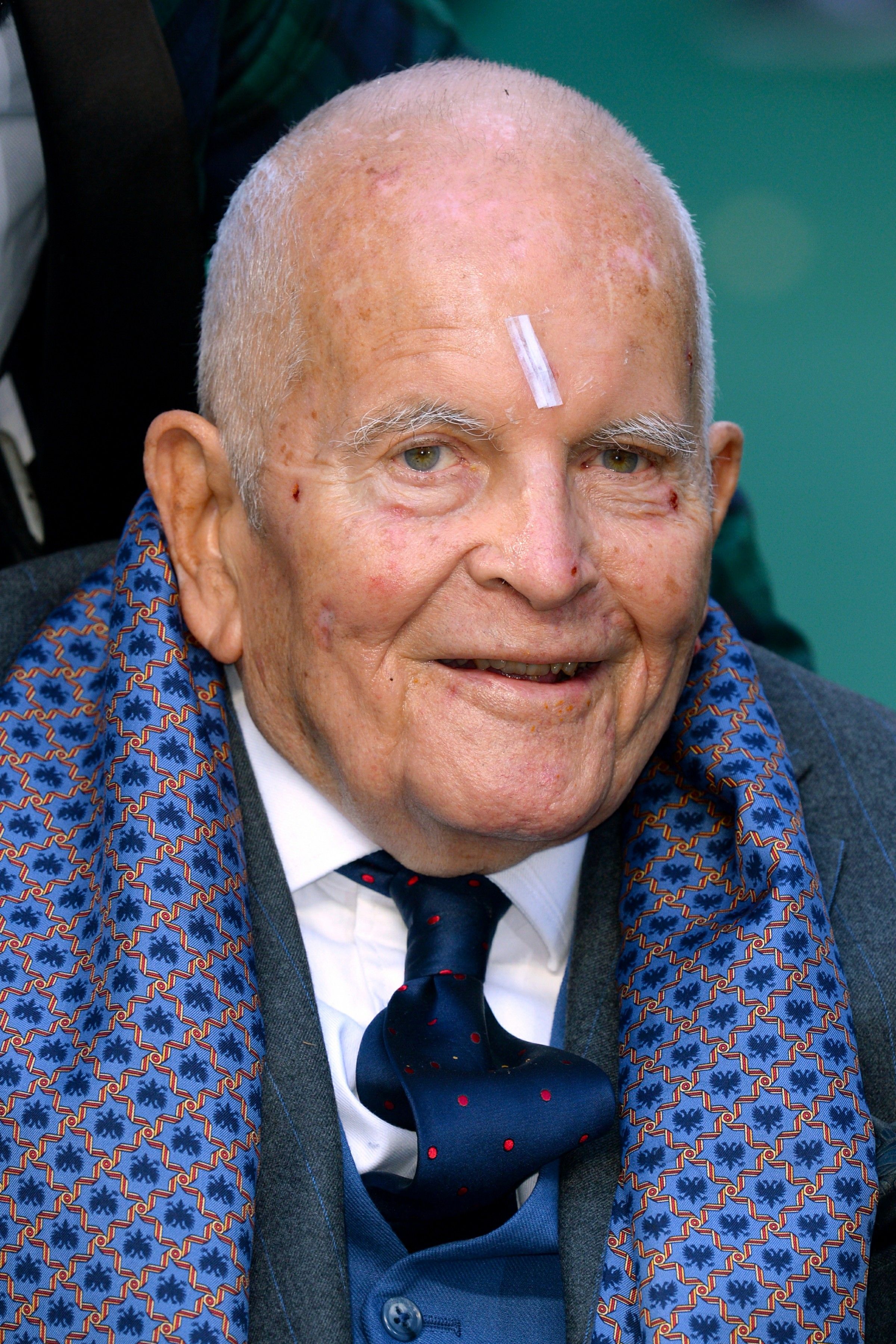 Tiro en la cabeza de Ian Holm