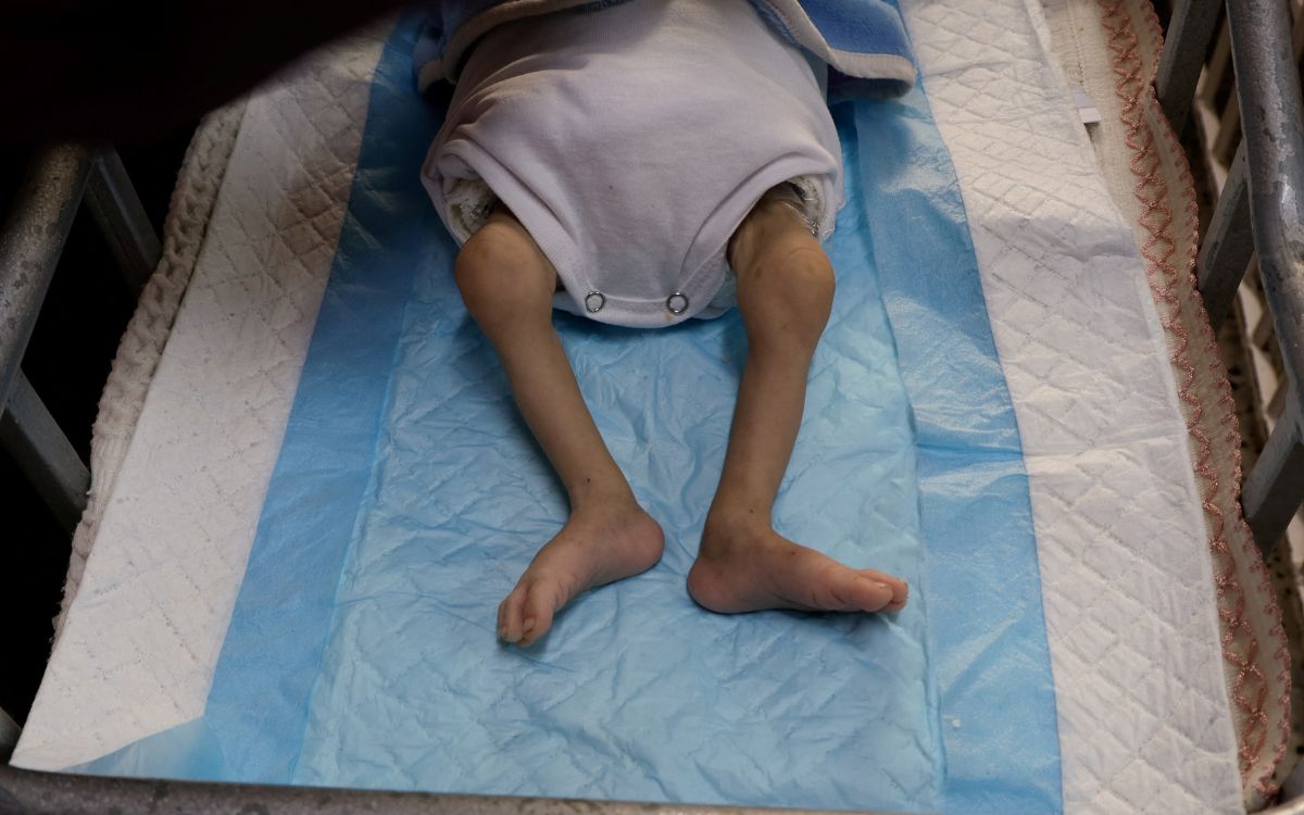 Al menos 57 niños han muerto de hambre en Gaza por bloqueo israelí, estima OMS