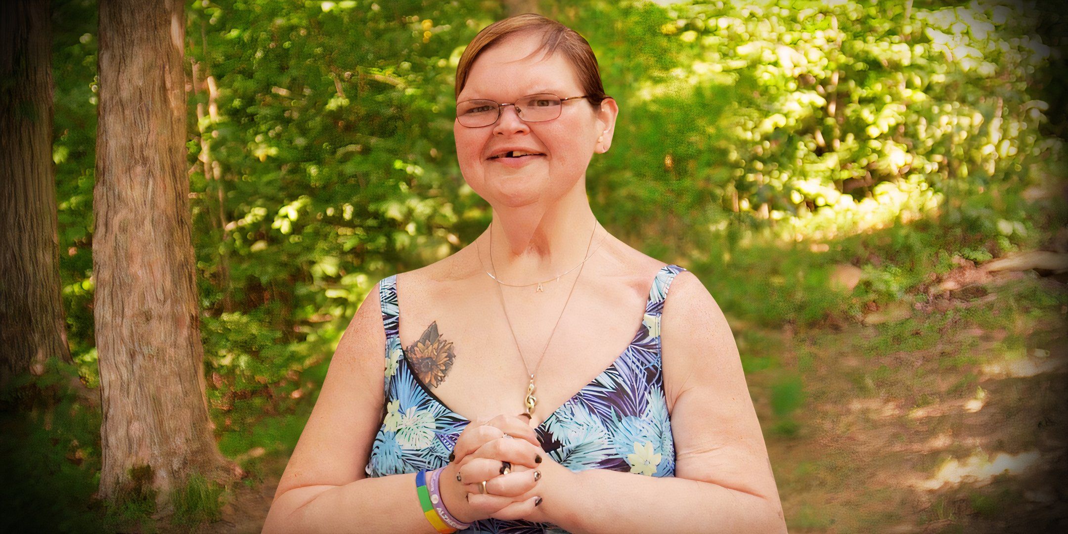 ¿Son extremos los resultados de la cirugía de eliminación de la piel de Tammy de 1000 lb hermanas? (Hechos sobre el estiramiento facial)