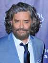 Tiro en la cabeza de Timothy Omundson