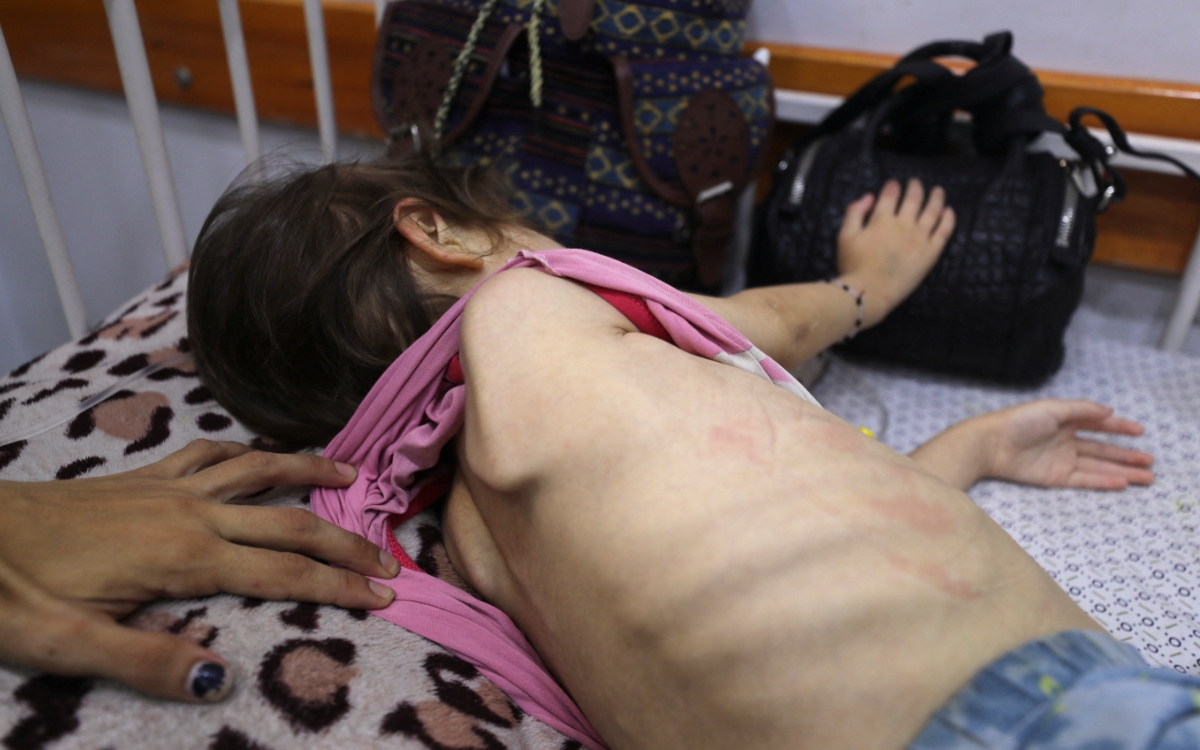 Excepto Estados Unidos, todos los países del Consejo de Seguridad de la ONU exigen fin de la hambruna en Gaza