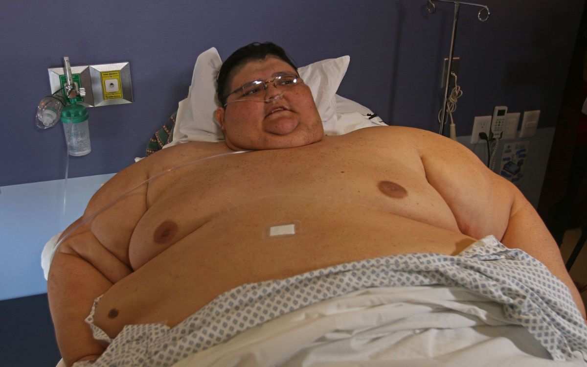 Muere Juan Pedro Franco, mexicano conocido por haber sido el hombre más obeso del mundo