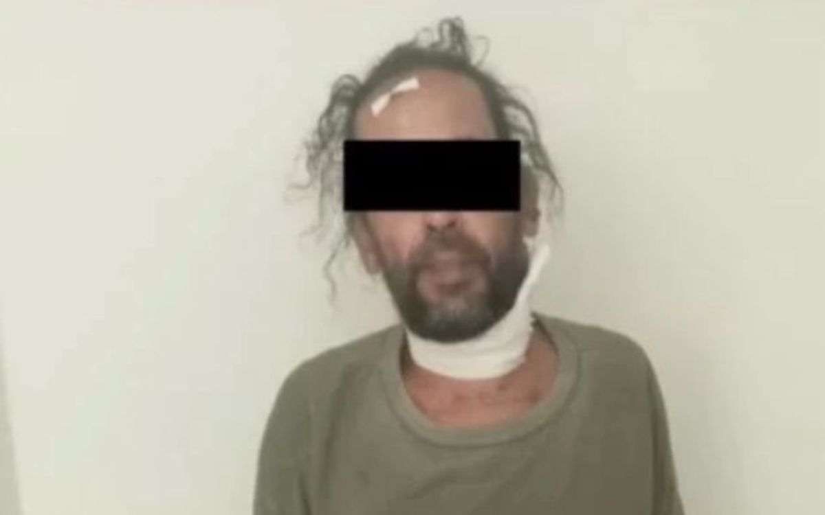 Por crueldad animal detienen y vinculan a proceso a músico, Manfredo Ariel; tenía más de 60 perros hacinados