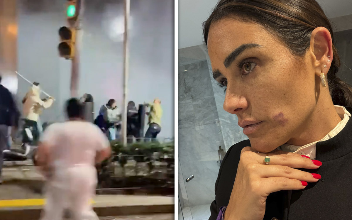Rojo de la Vega denuncia agresión durante operativo en Zona Rosa; SSC asegura que fue riña con comerciantes