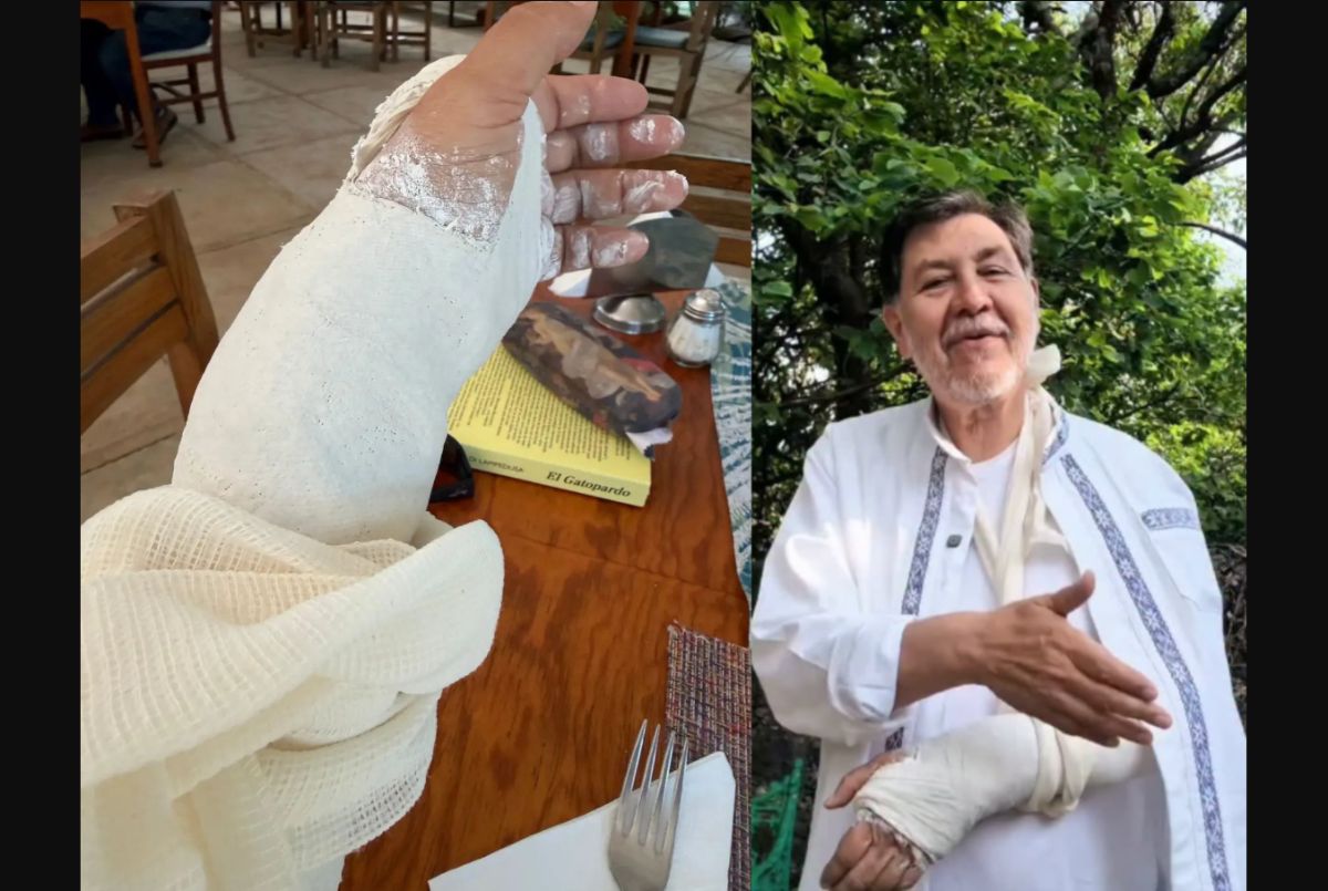 Fernández Noroña se fractura la muñeca tras sufrir una caída durante caminata en Tepoztlán